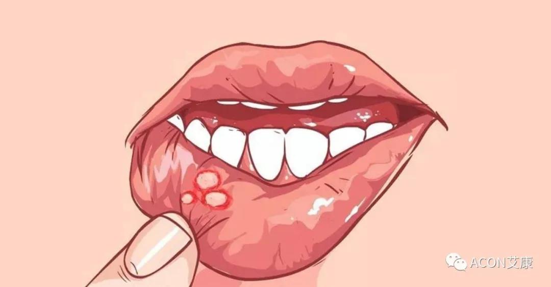 哪些小病容易讓人忽視，最后造成越拖越嚴(yán)重呢？