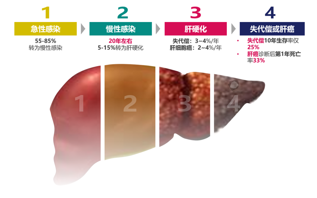 悄悄變成肝硬化、肝癌，很多人感染了卻不知道