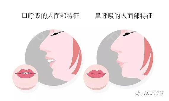 過敏性鼻炎會讓孩子變傻？！家長該如何應(yīng)對